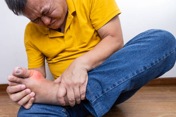 Cách bổ sung dinh dưỡng cho người bệnh gout